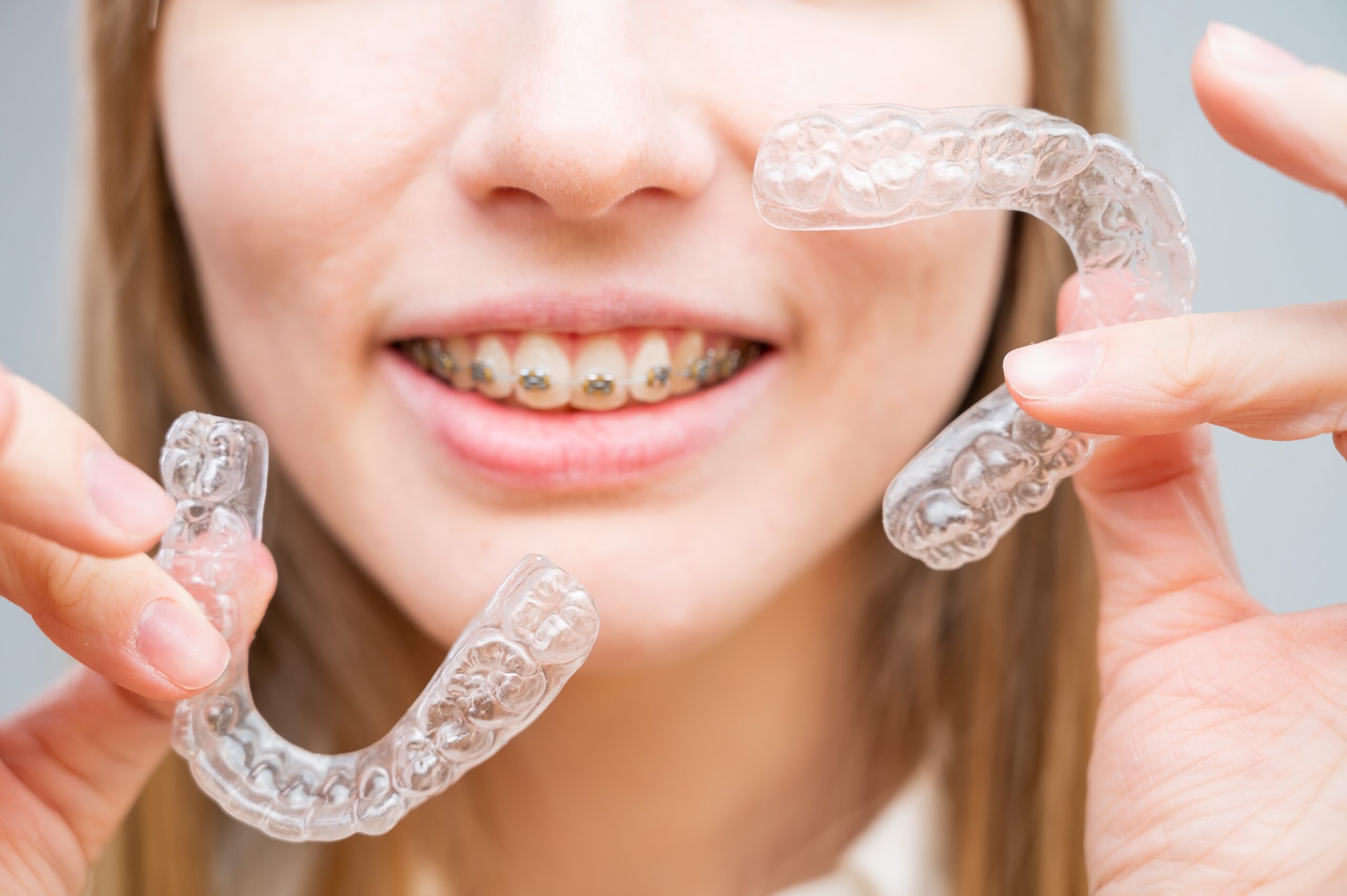 mansfield orthodontist