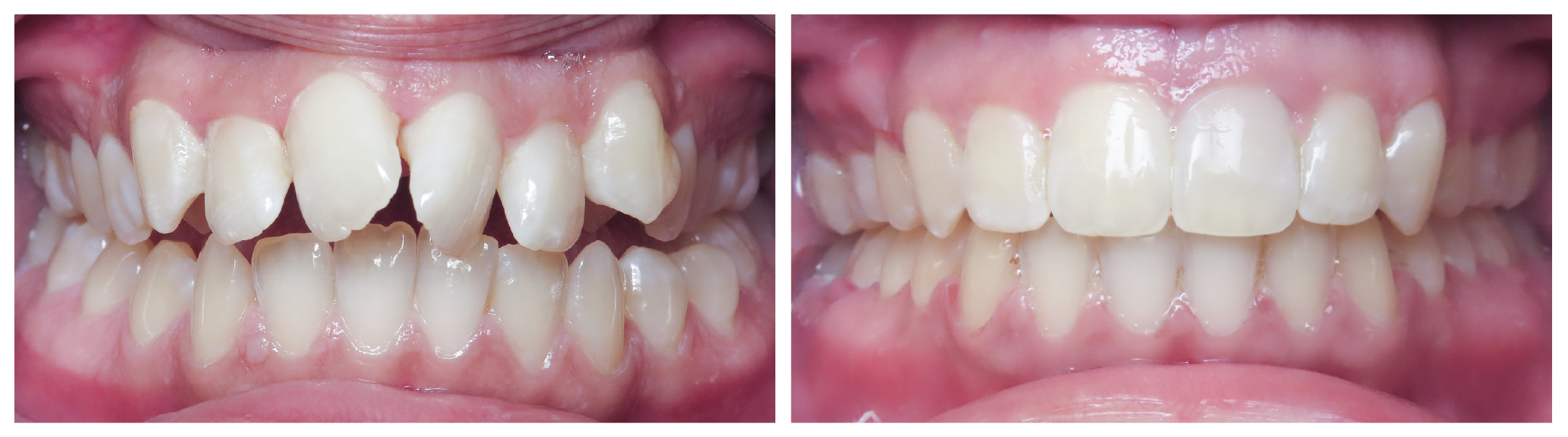 2026-6-24_SunflowerOrtho_B&APhotoEdits_ES-02