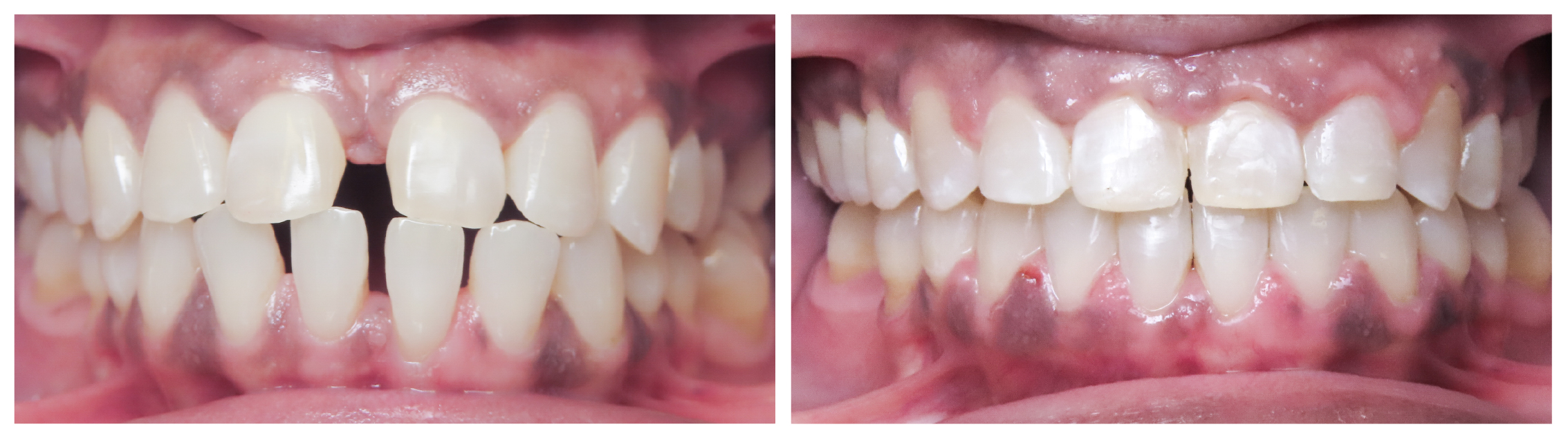 2026-6-24_SunflowerOrtho_B&APhotoEdits_ES-05